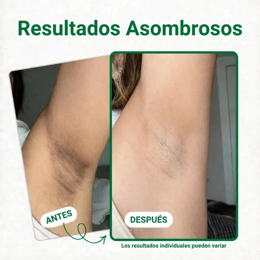 Parches Lumi aclarantes