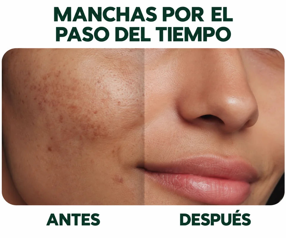 Comparación ilustrativa de manchas por el paso del tiempo
